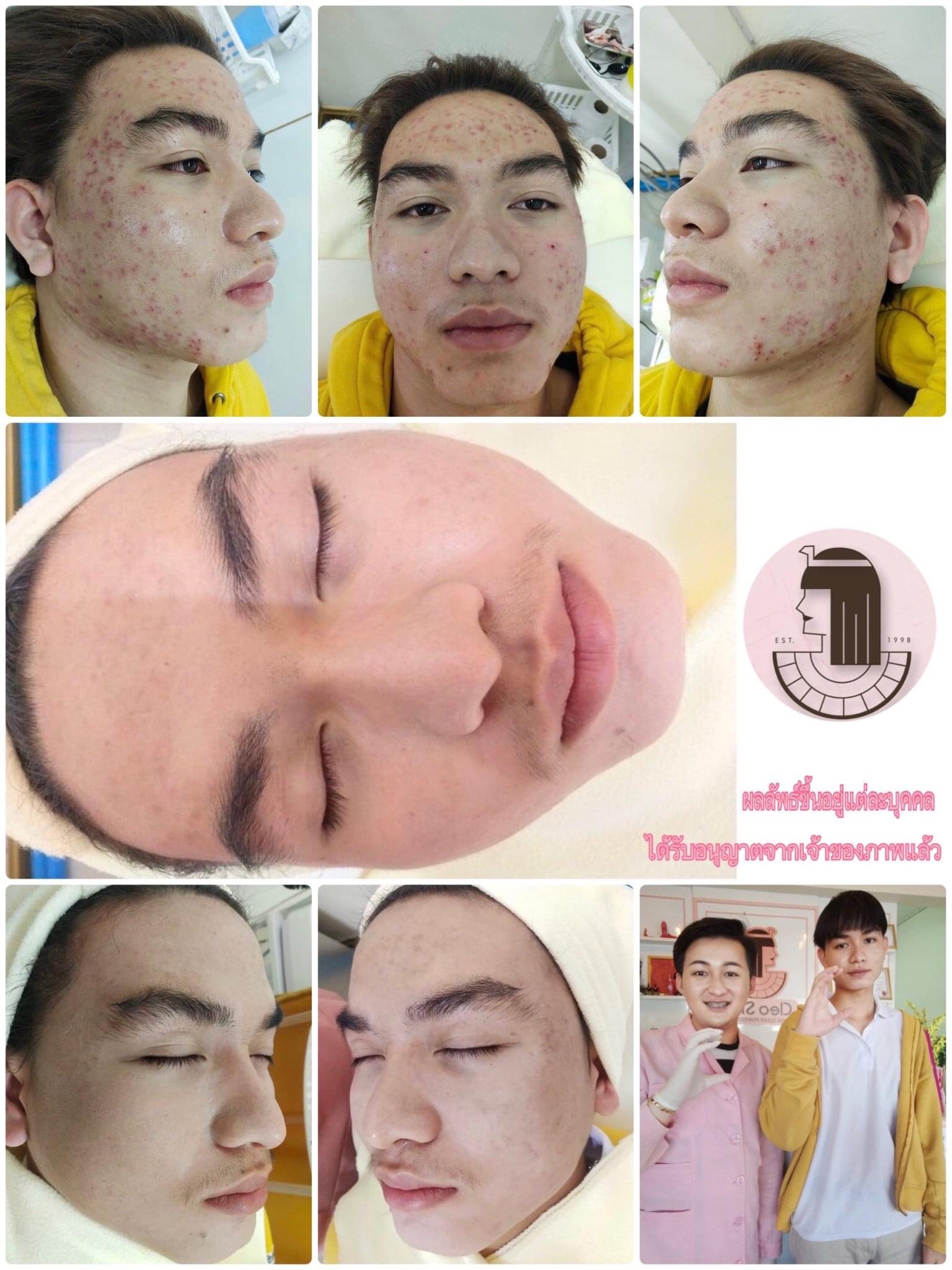 รีวิว ปี 62