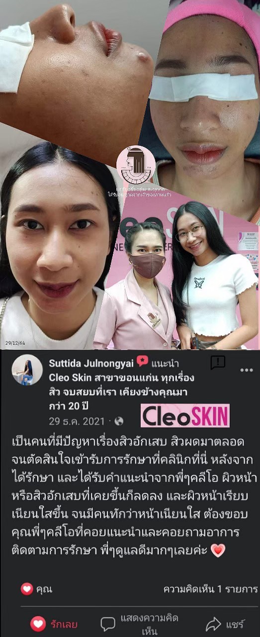 รีวิว ปี 62