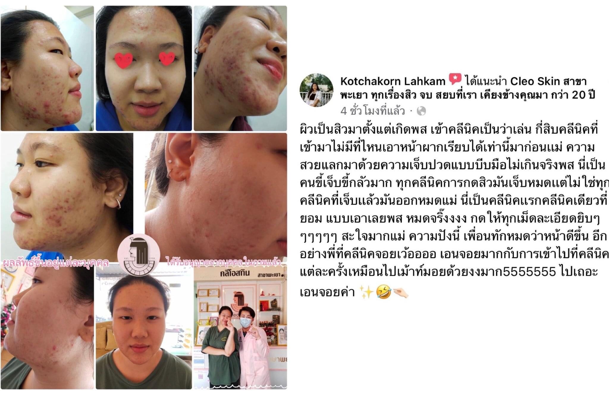 รีวิว ปี 62