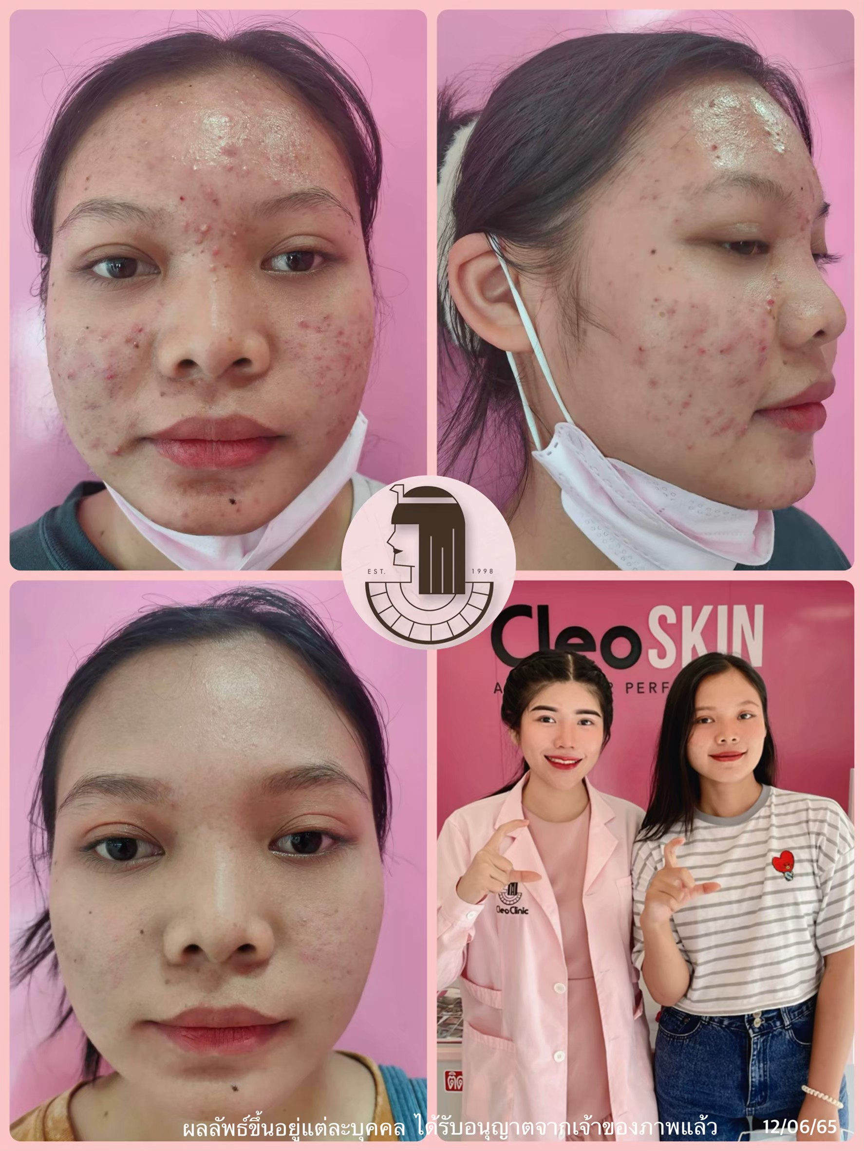 รีวิว ปี 62