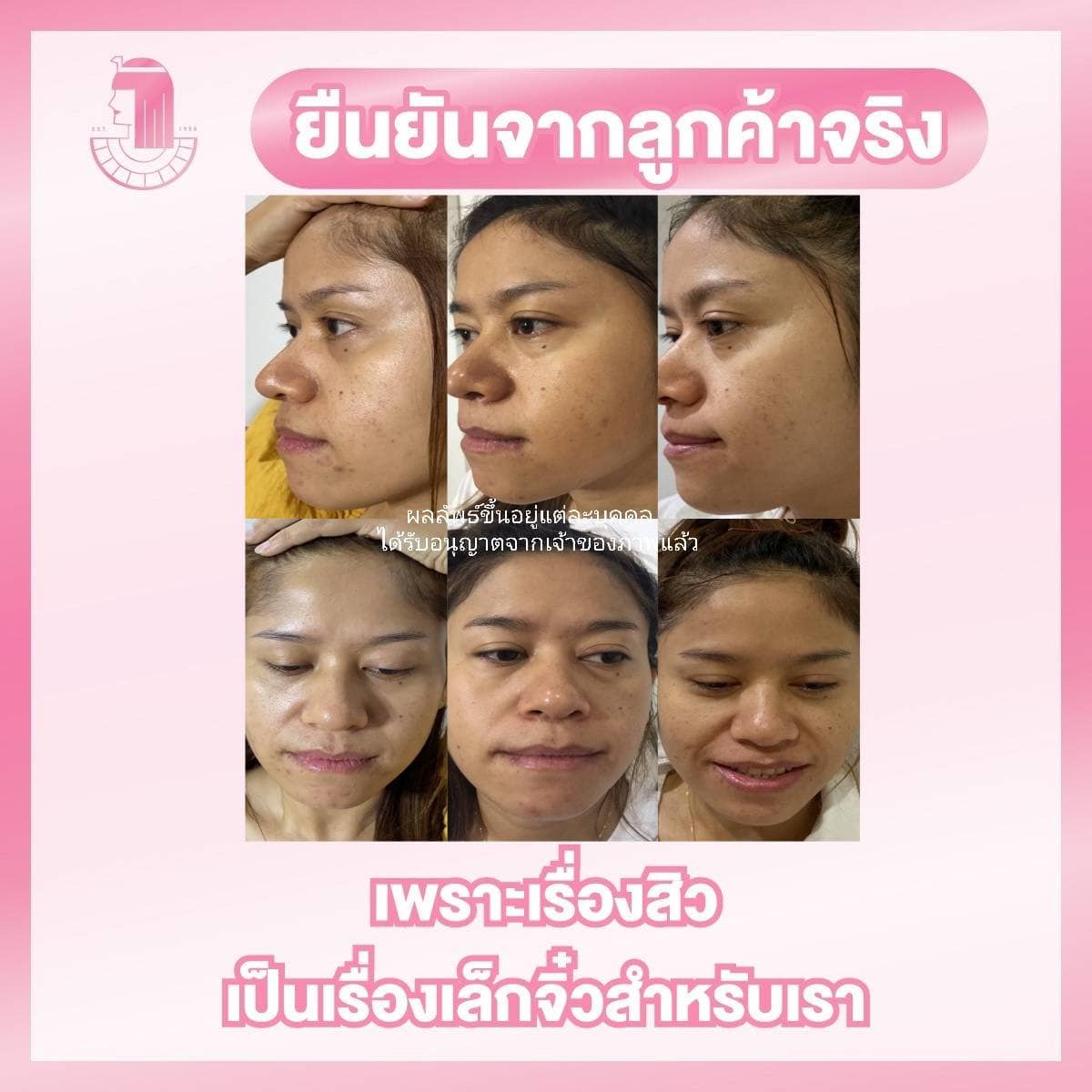 รีวิว ปี 62