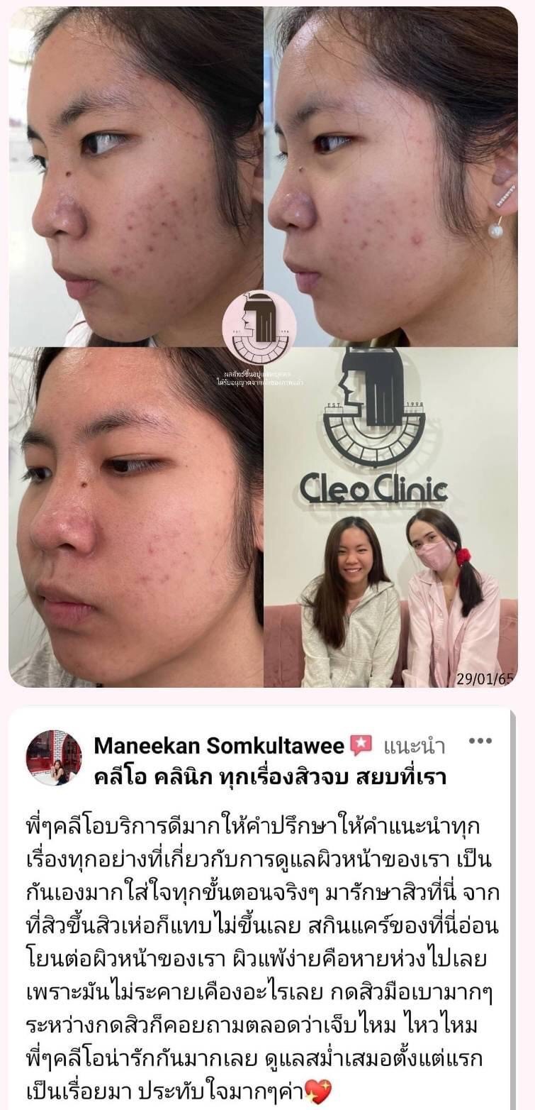 รีวิว ปี 62