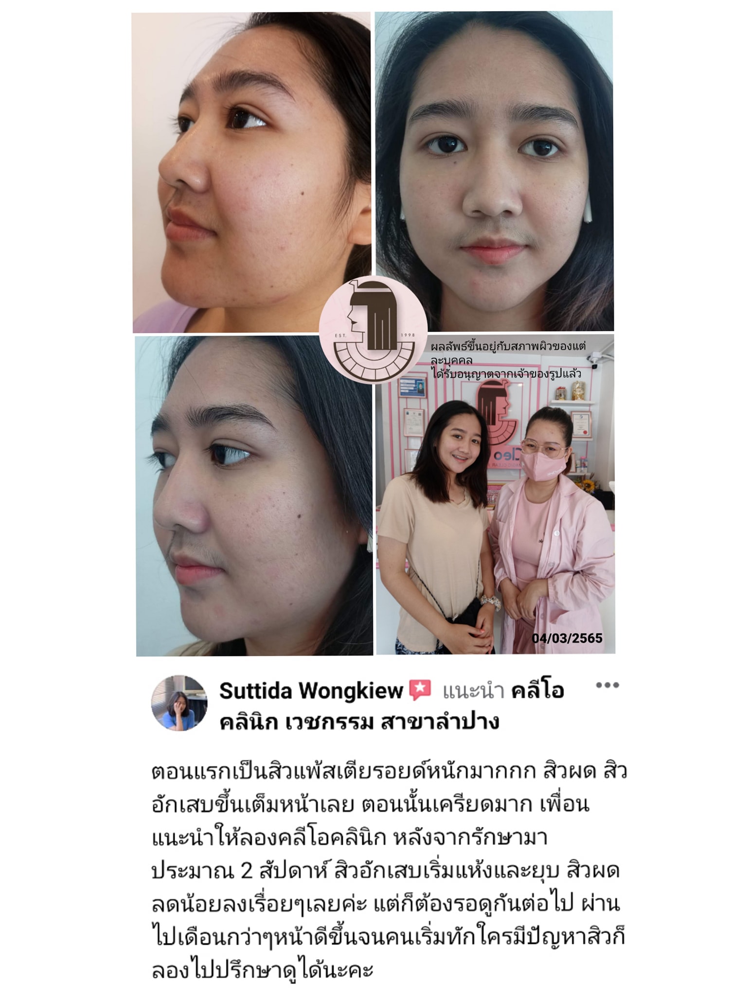 รีวิว ปี 62