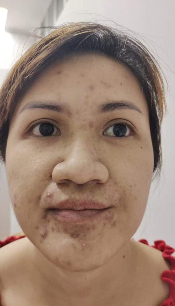 รีวิว ปี 62