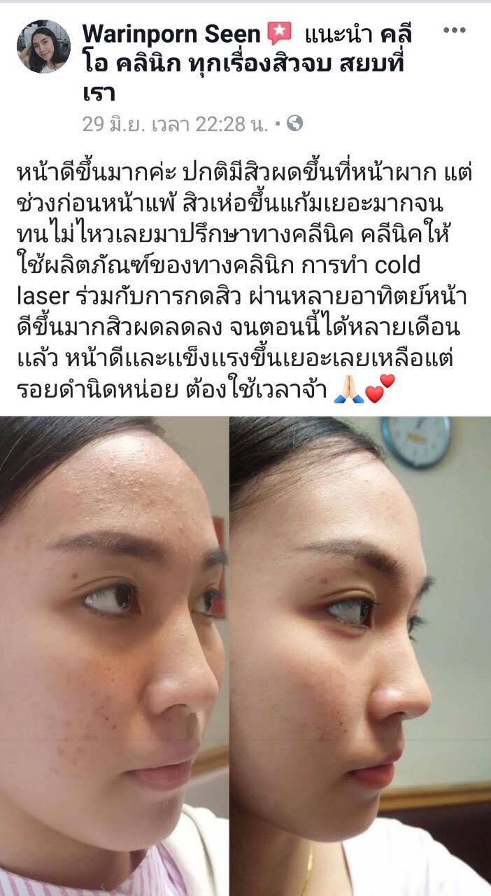 รีวิว ปี 62