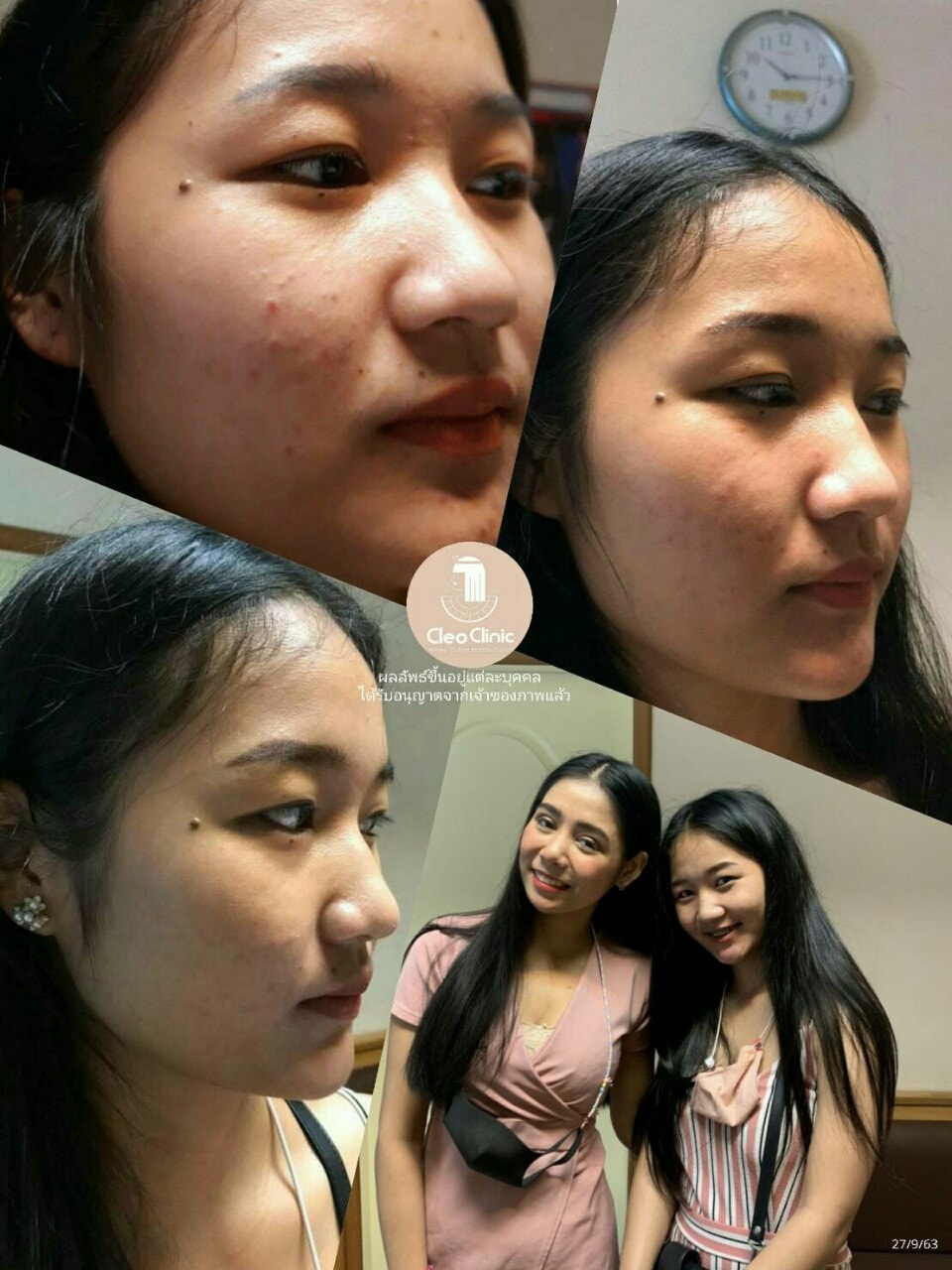 รีวิว ปี 62