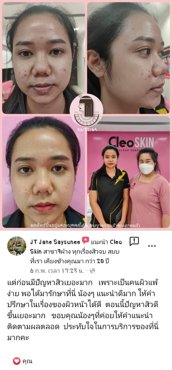 รีวิว ปี 62