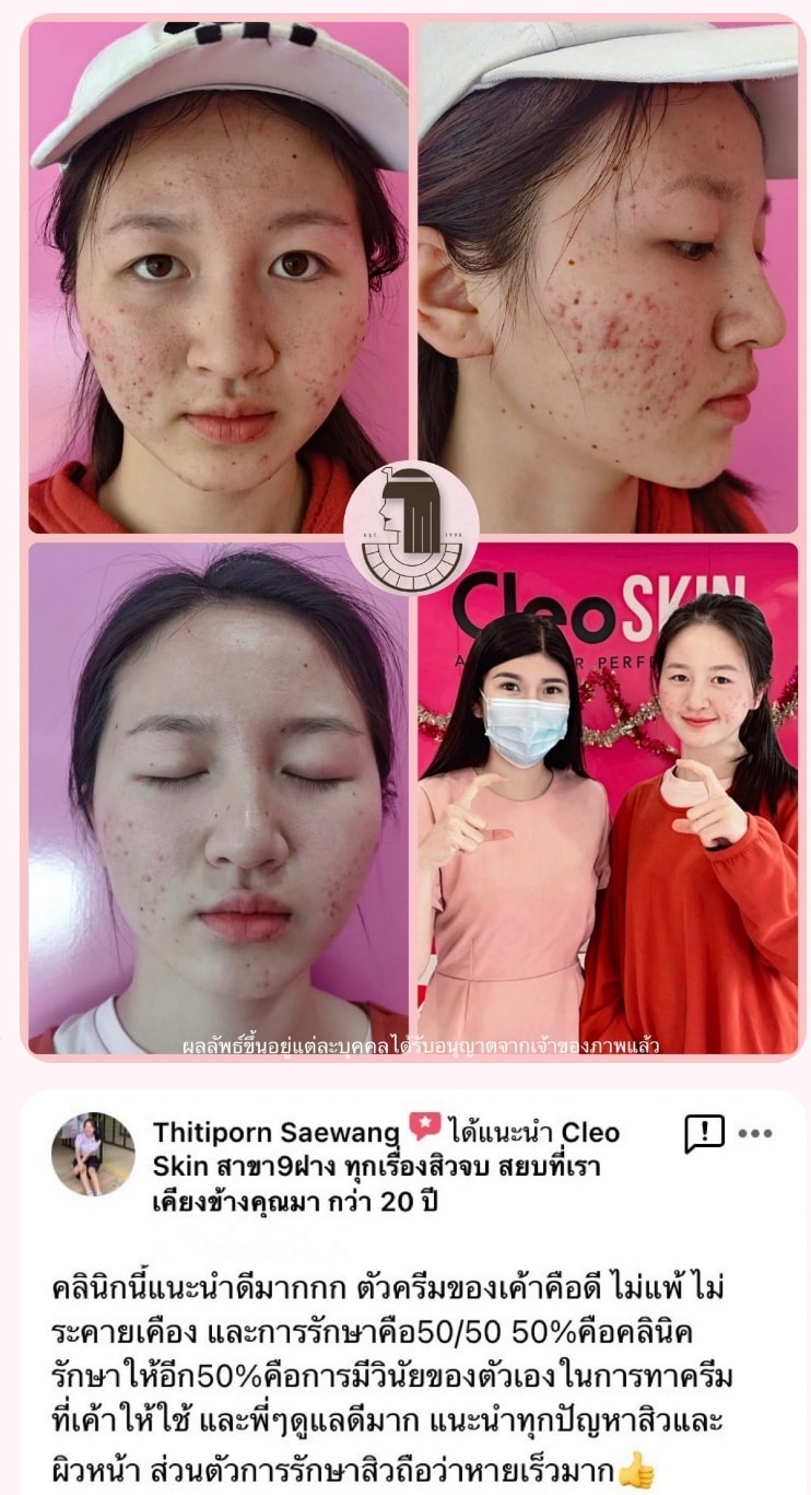 รีวิว ปี 62