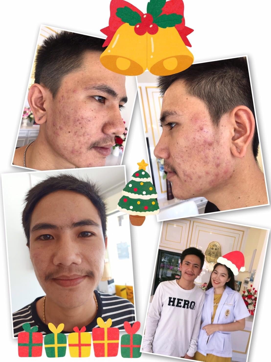 รีวิว ปี 62