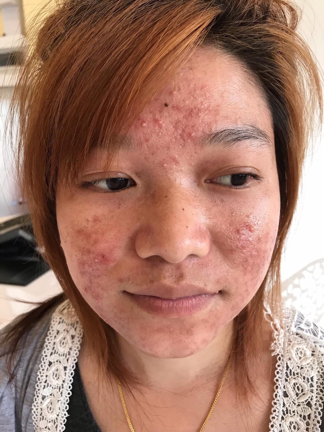 รีวิว ปี 62