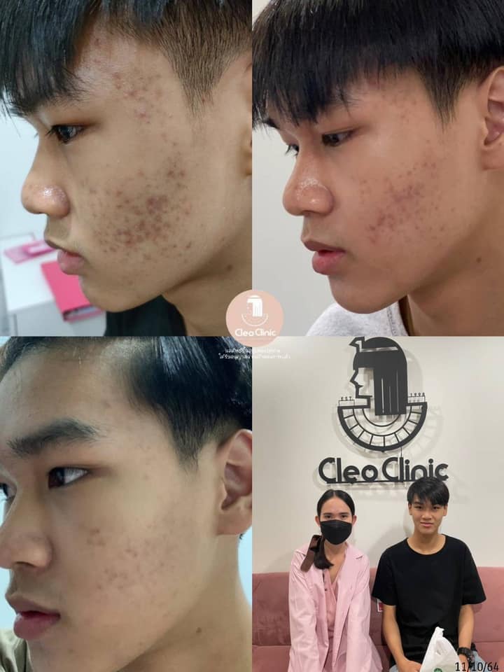 รีวิว ปี 62