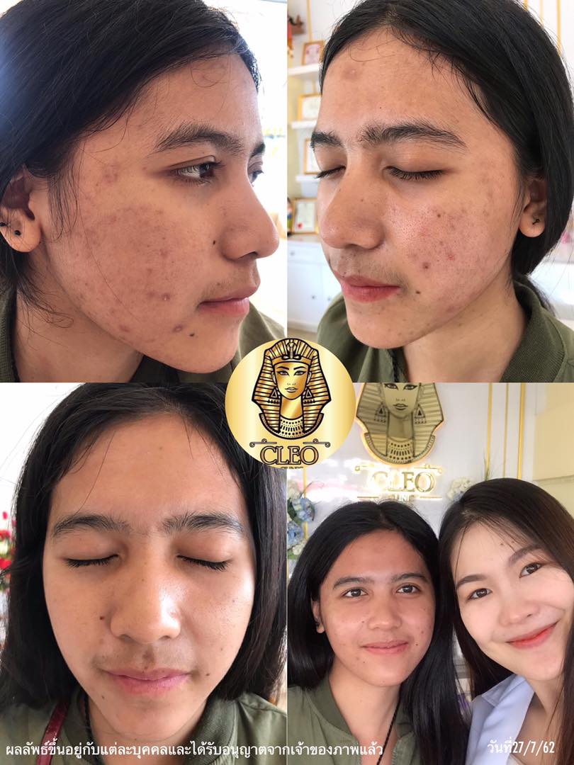 รีวิว ปี 62