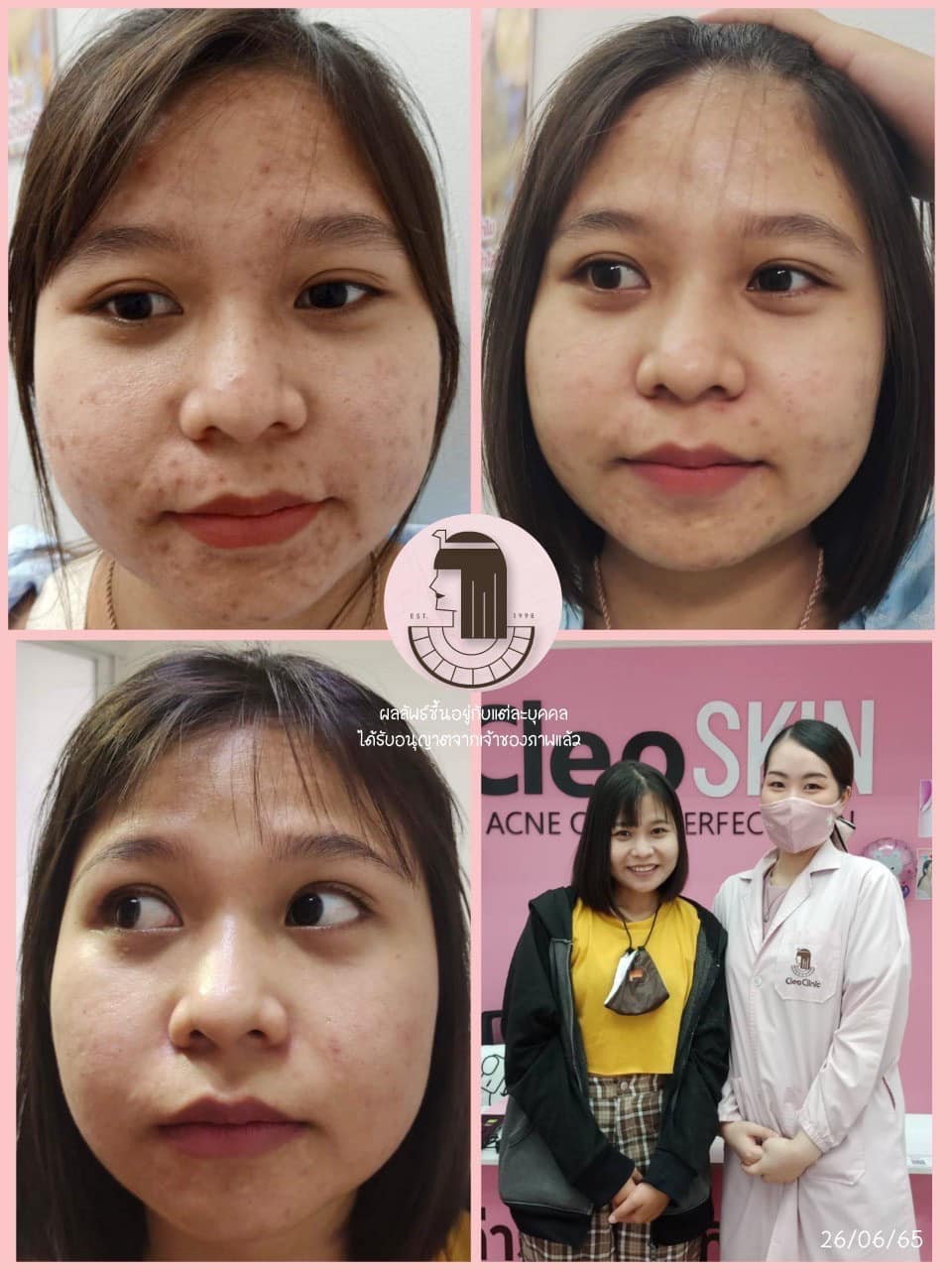 รีวิว ปี 62