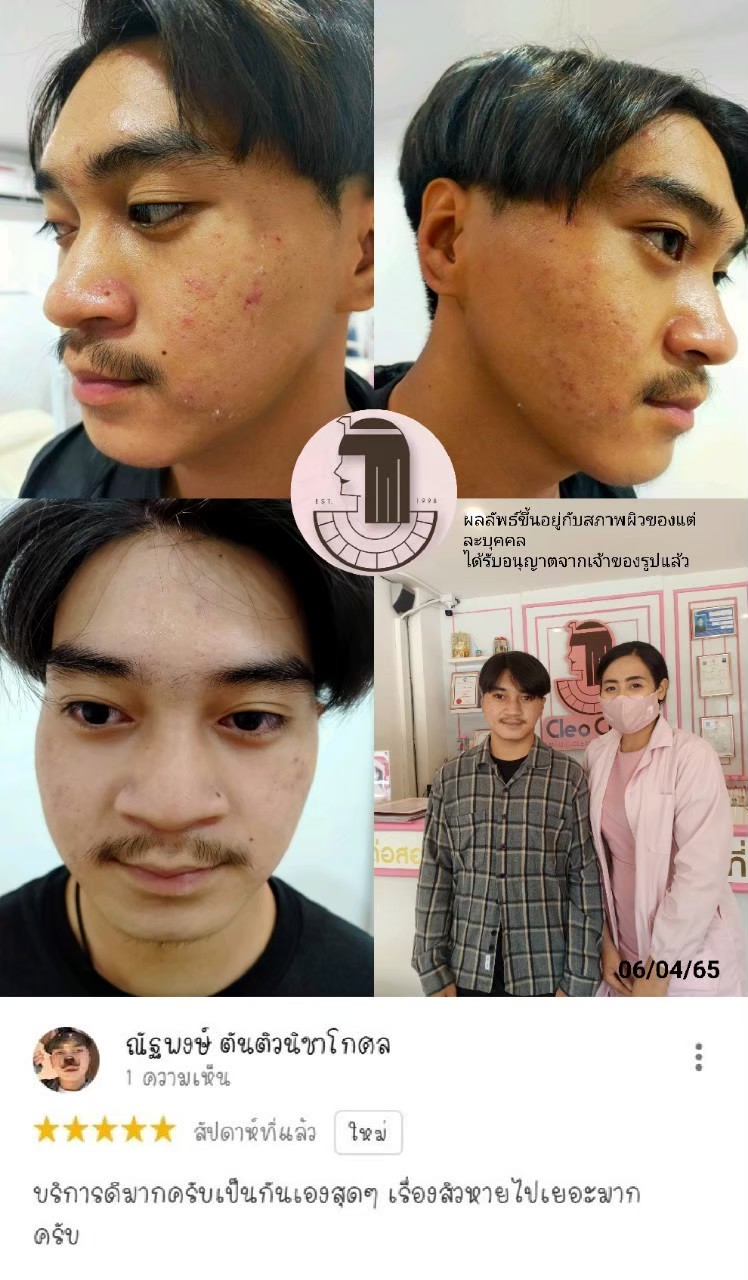 รีวิว ปี 62