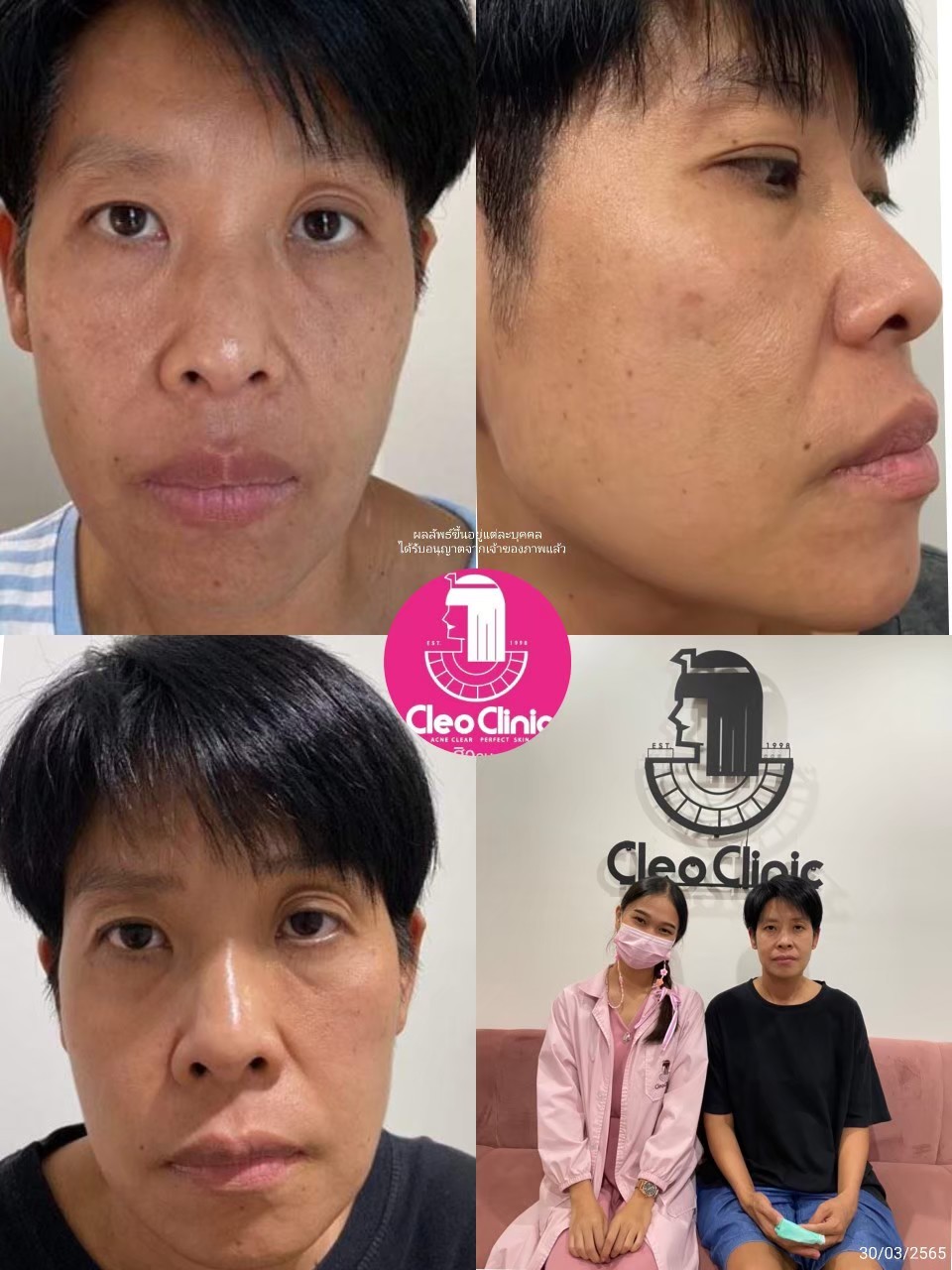 รีวิว ปี 62