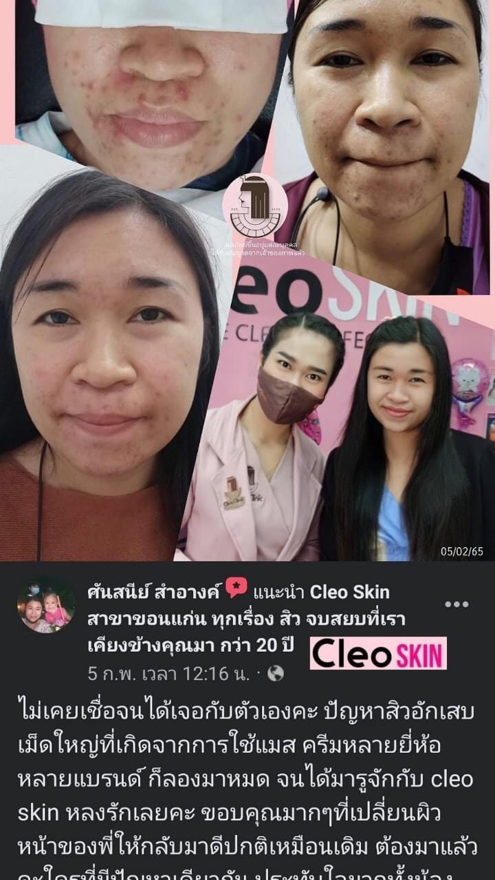 รีวิว ปี 62