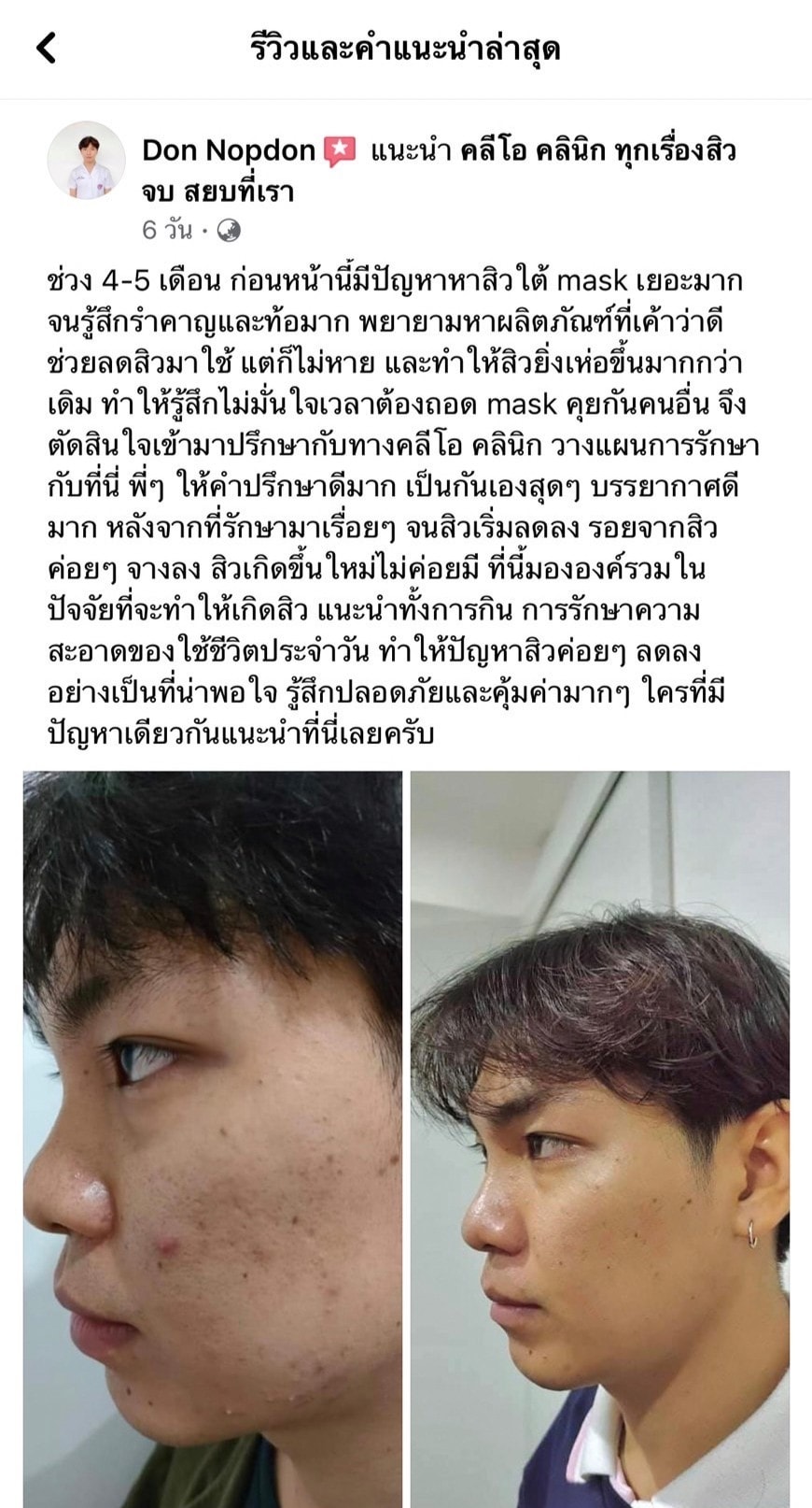 รีวิว ปี 62