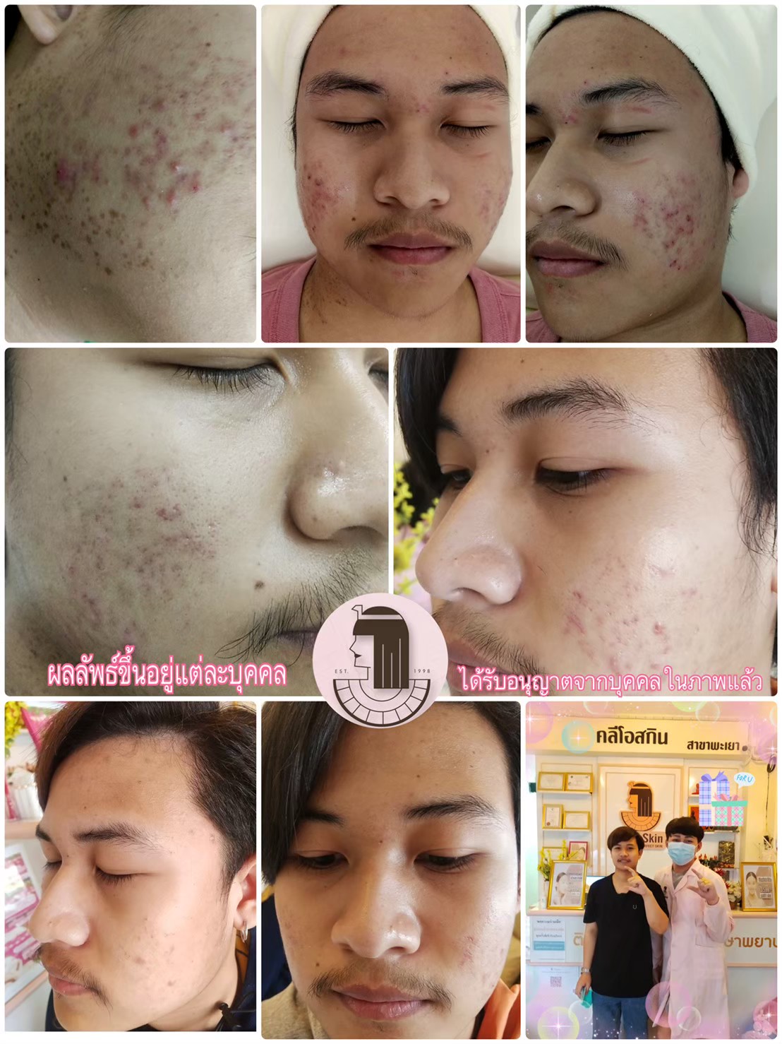 รีวิว ปี 62