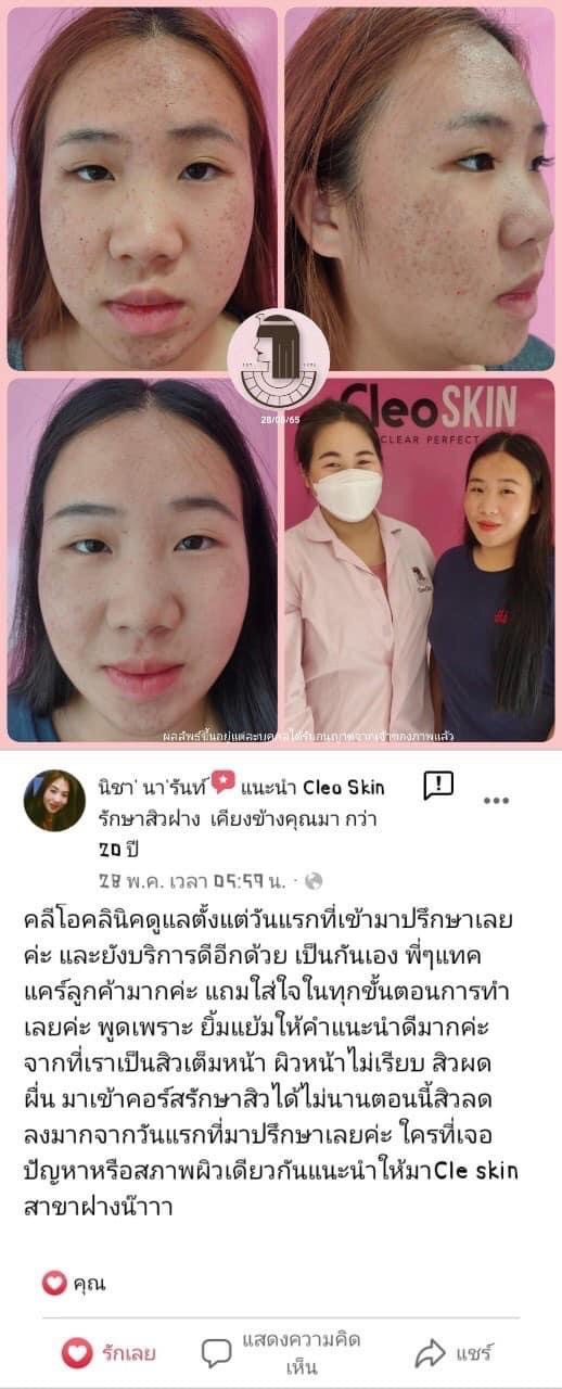 รีวิว ปี 62