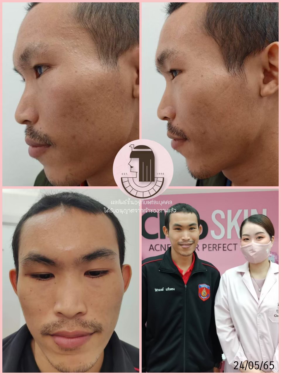 รีวิว ปี 62