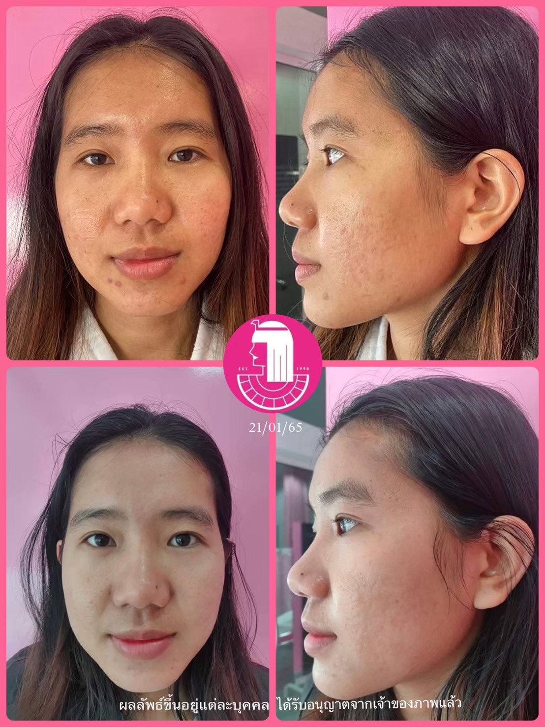 รีวิว ปี 62