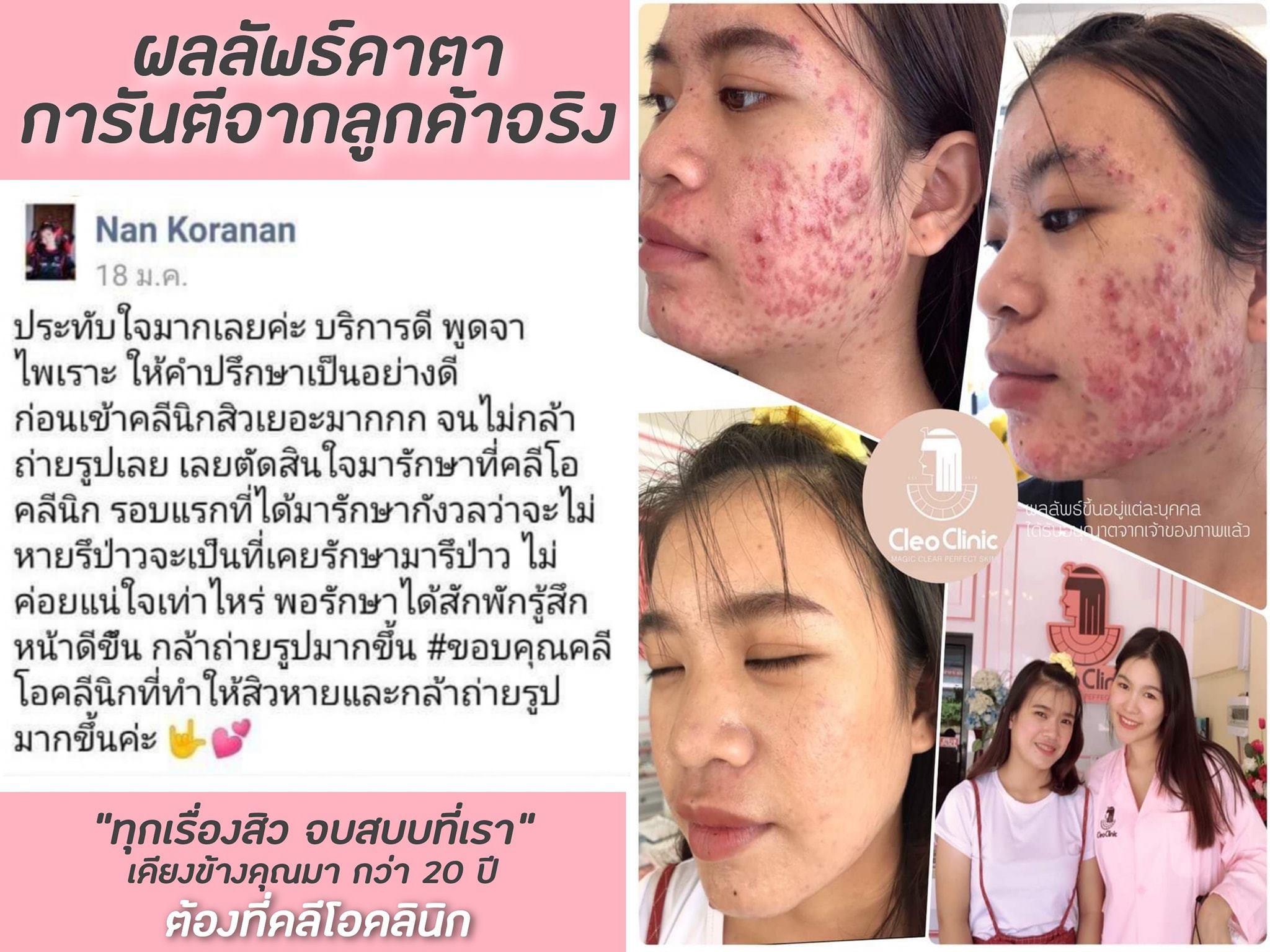 รีวิว ปี 62