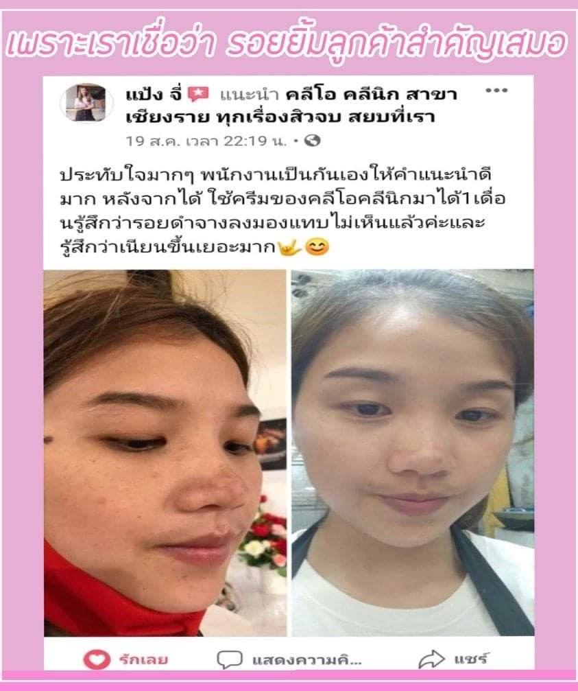 รีวิว ปี 62