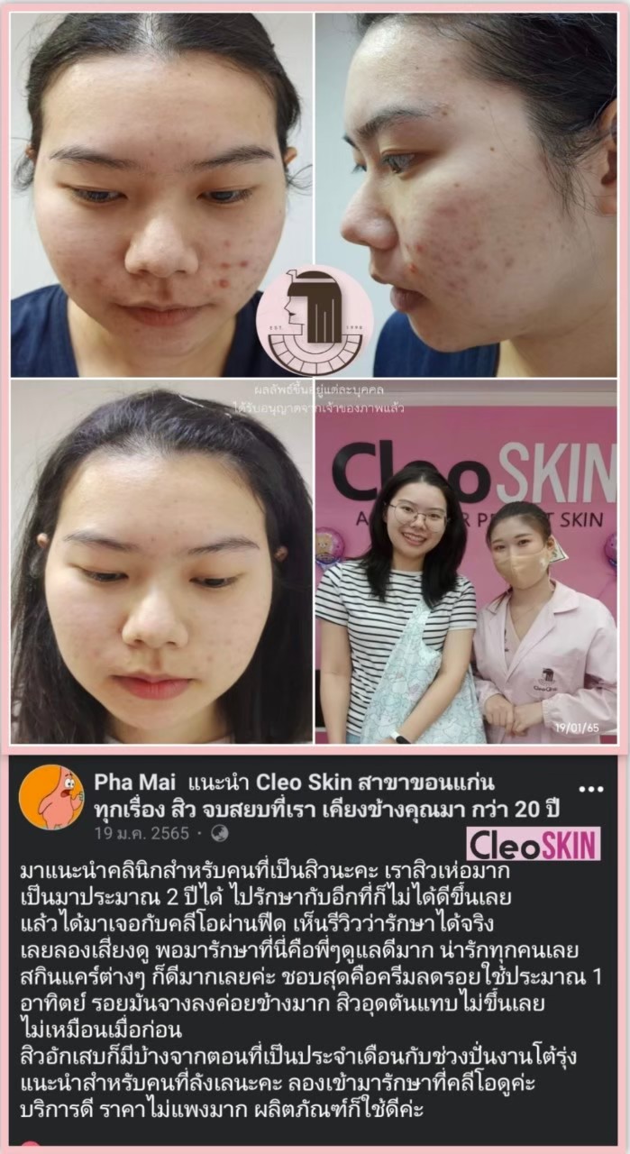 รีวิว ปี 62