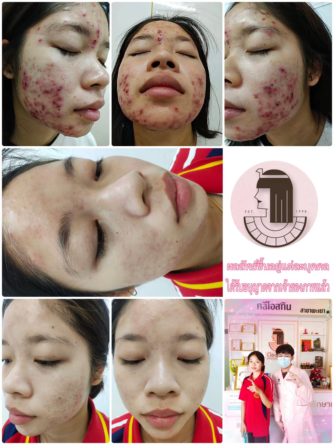 รีวิว ปี 62