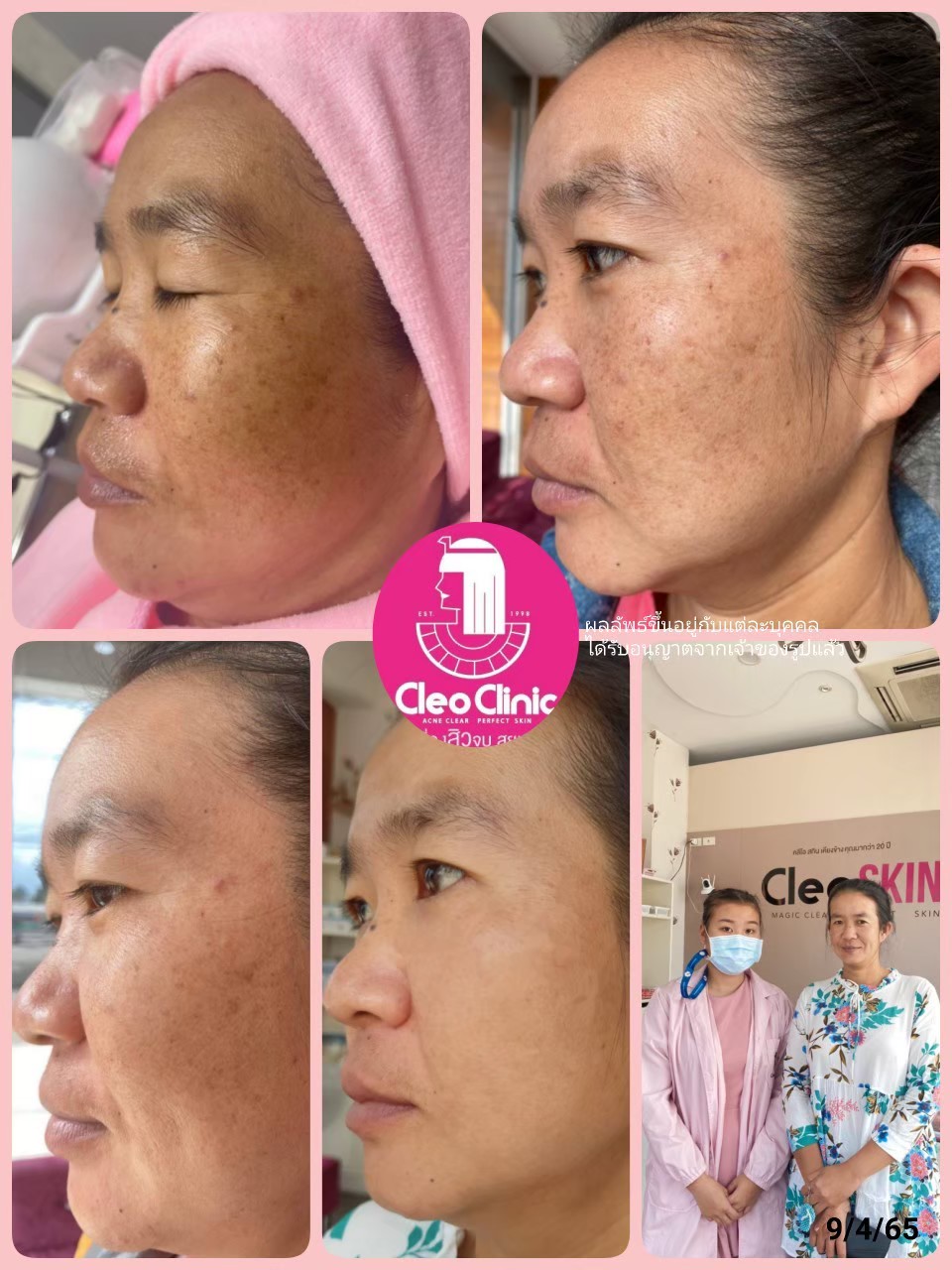 รีวิว ปี 62