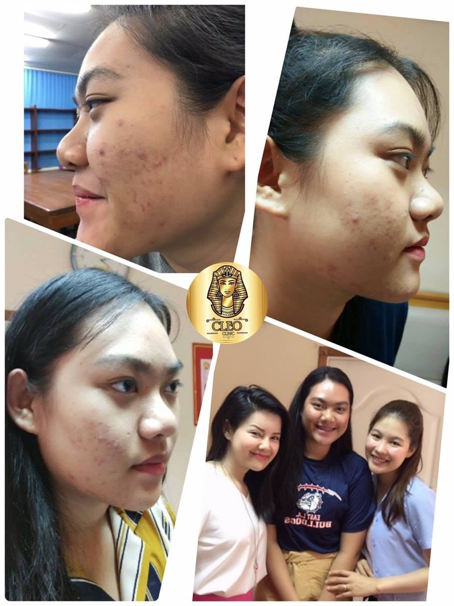 รีวิว ปี 62