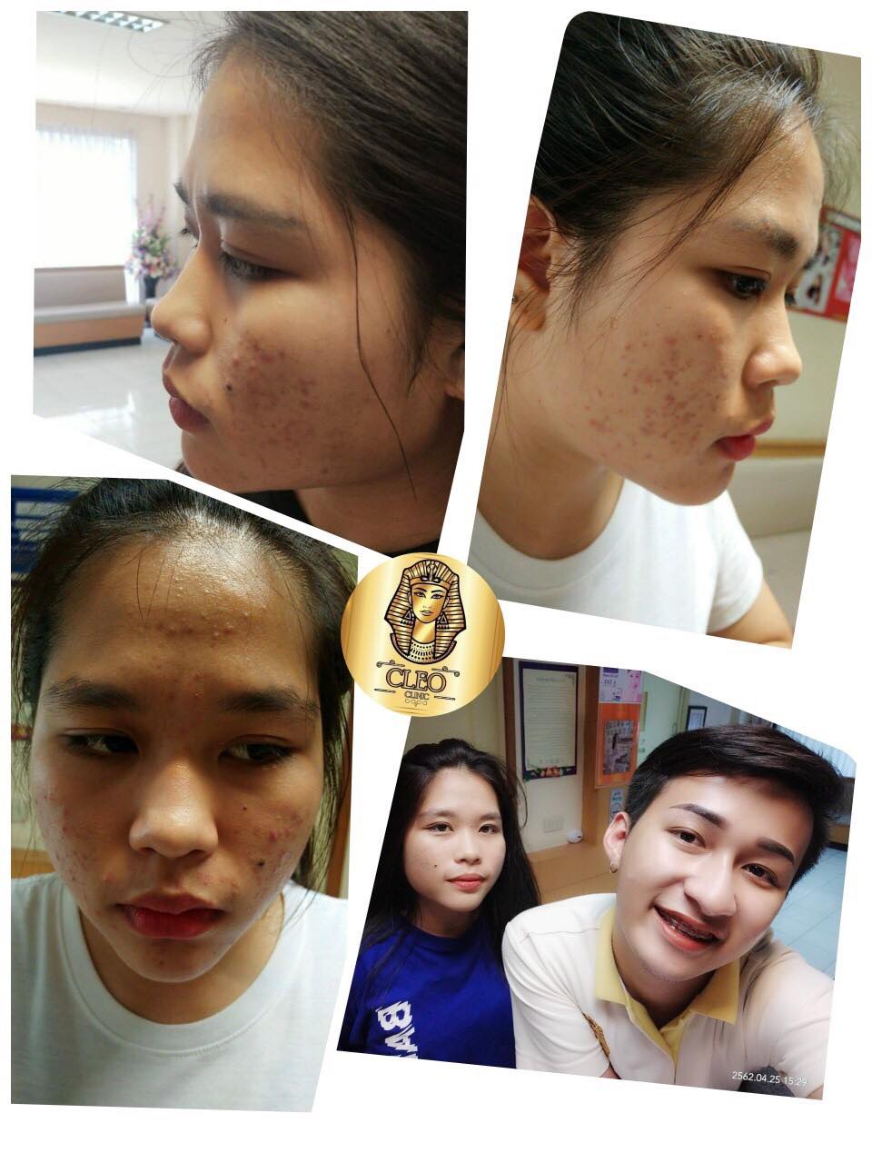 รีวิว ปี 62