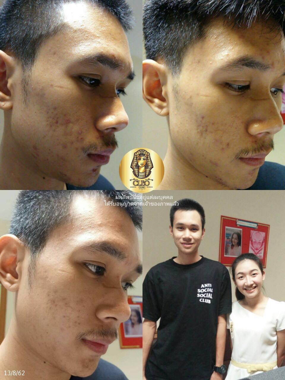 รีวิว ปี 62