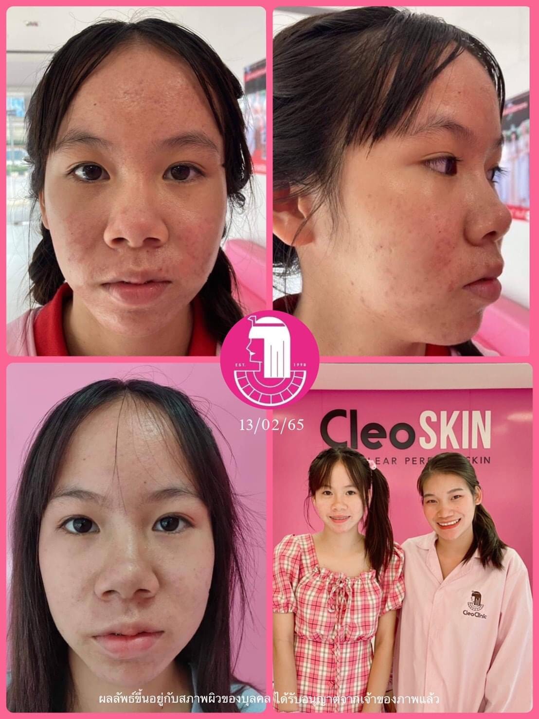 รีวิว ปี 62