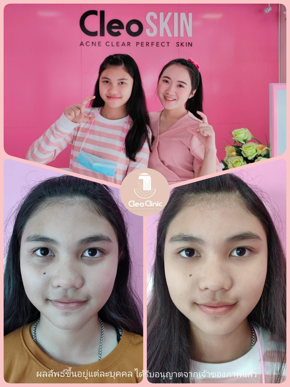 รีวิว ปี 62