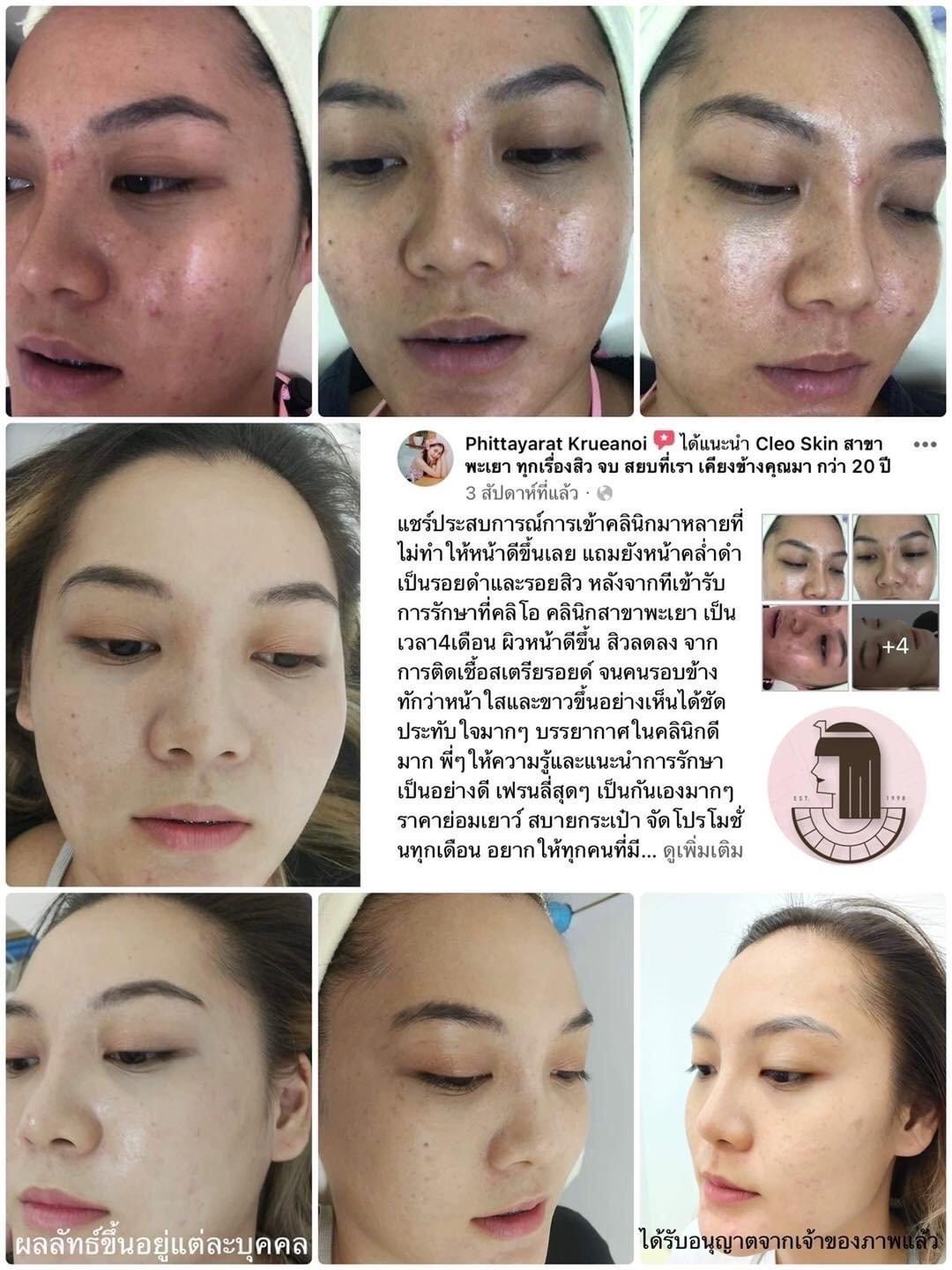 รีวิว ปี 62