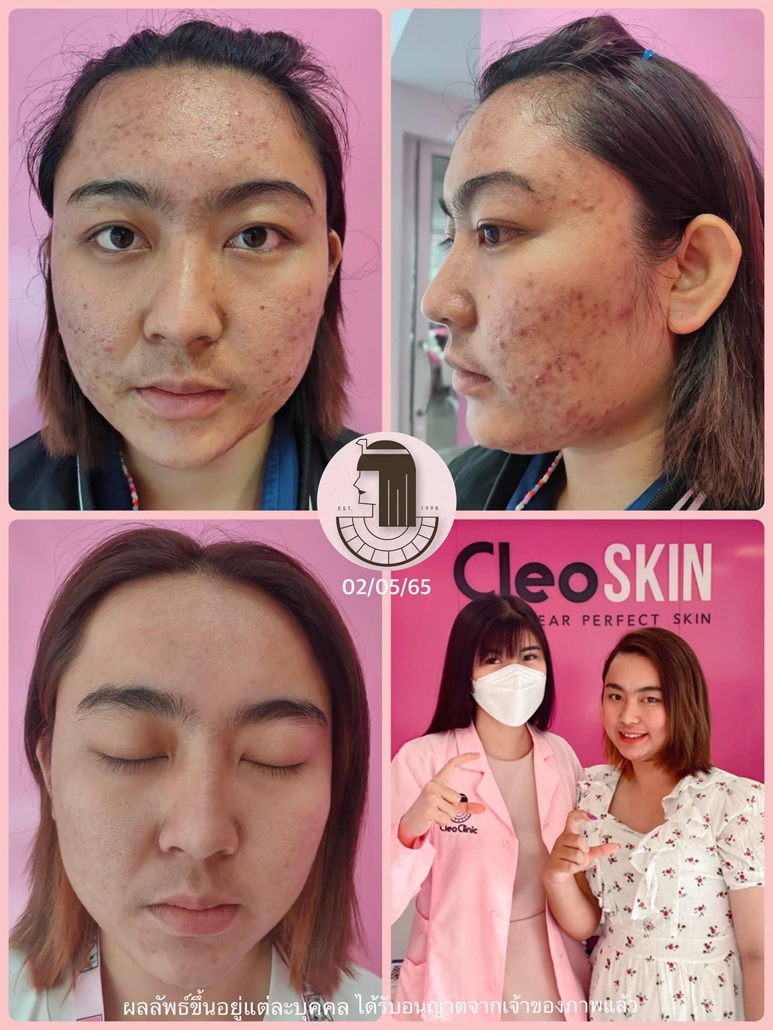 รีวิว ปี 62