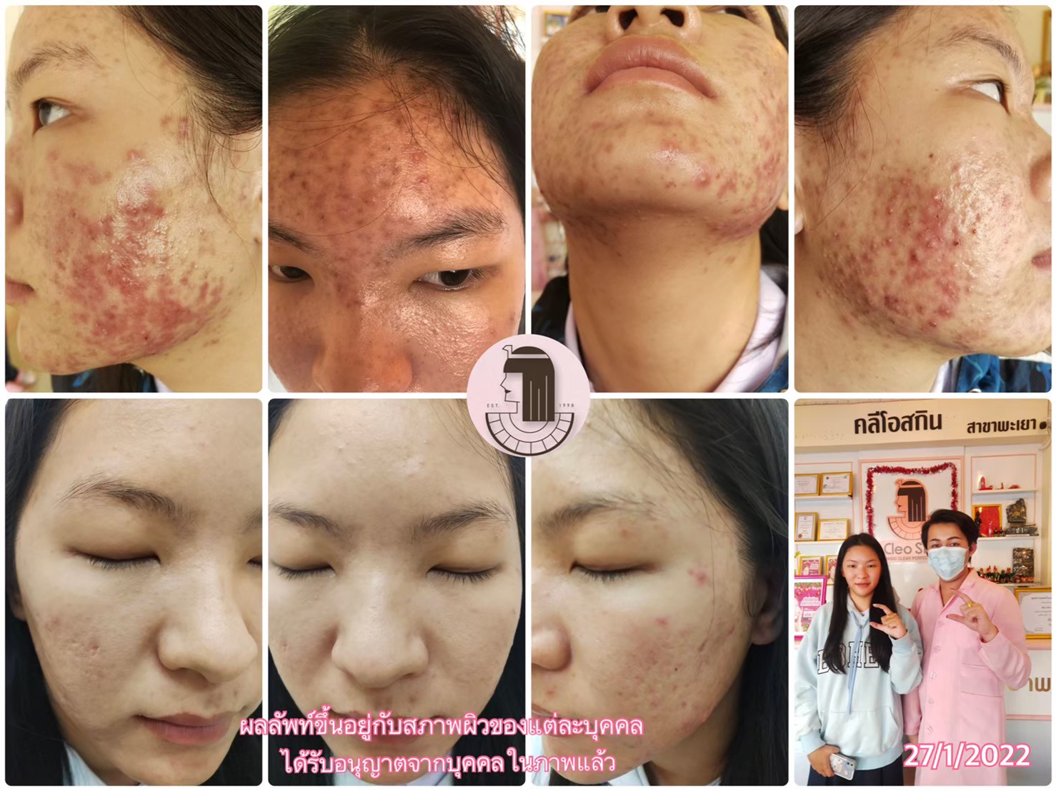 รีวิว ปี 62