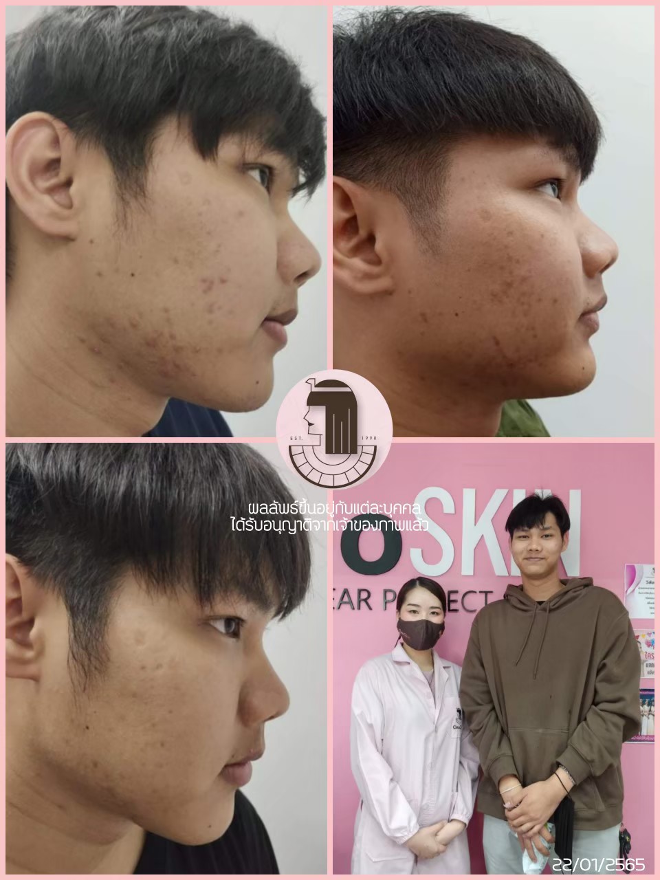 รีวิว ปี 62