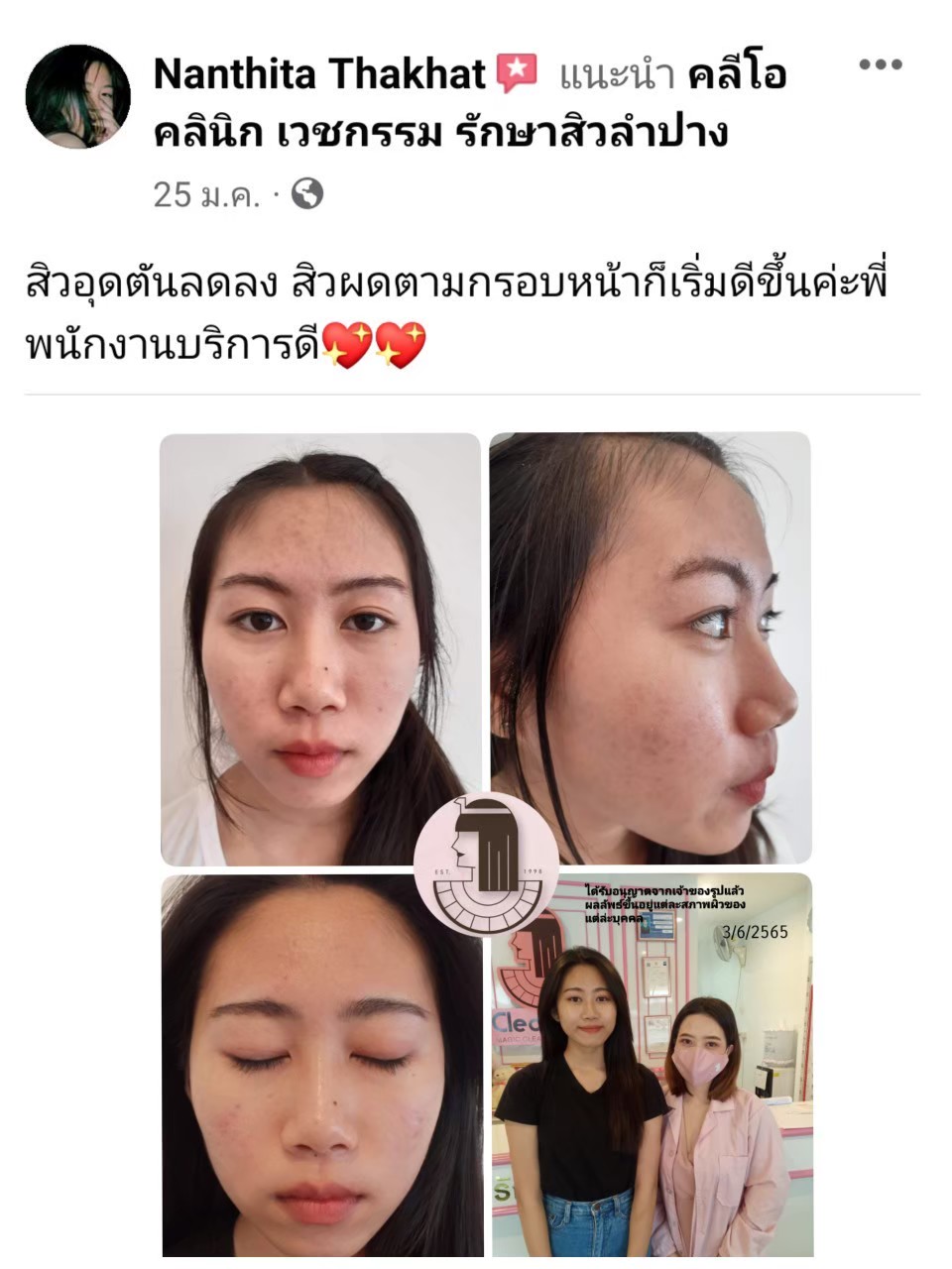 รีวิว ปี 62