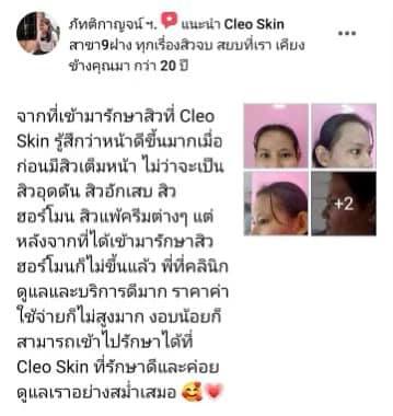 รีวิว ปี 62