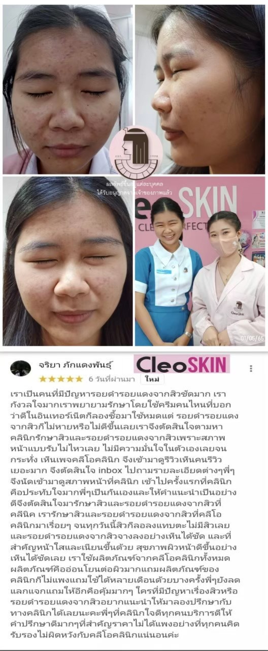 รีวิว ปี 62