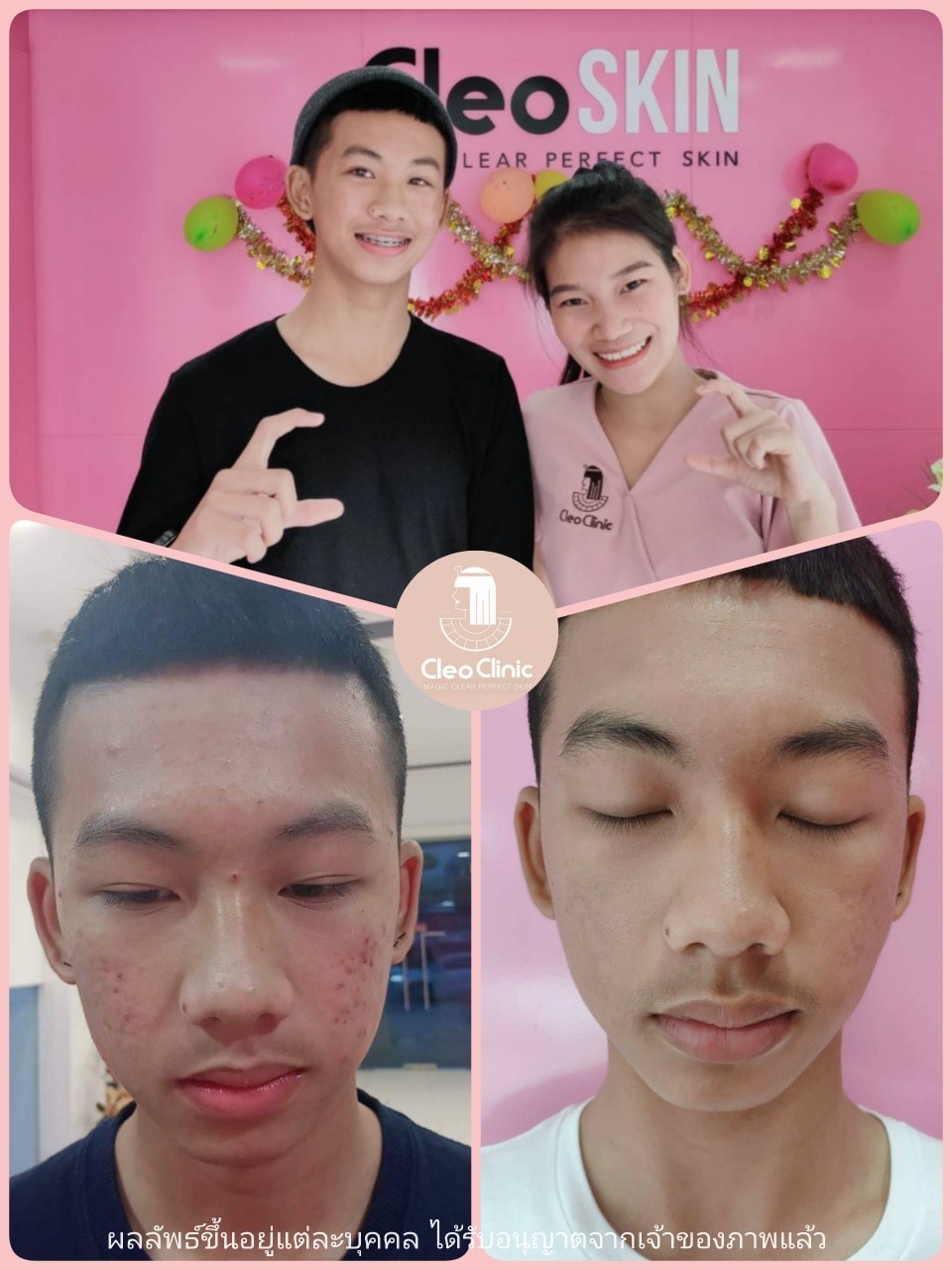 รีวิว ปี 62