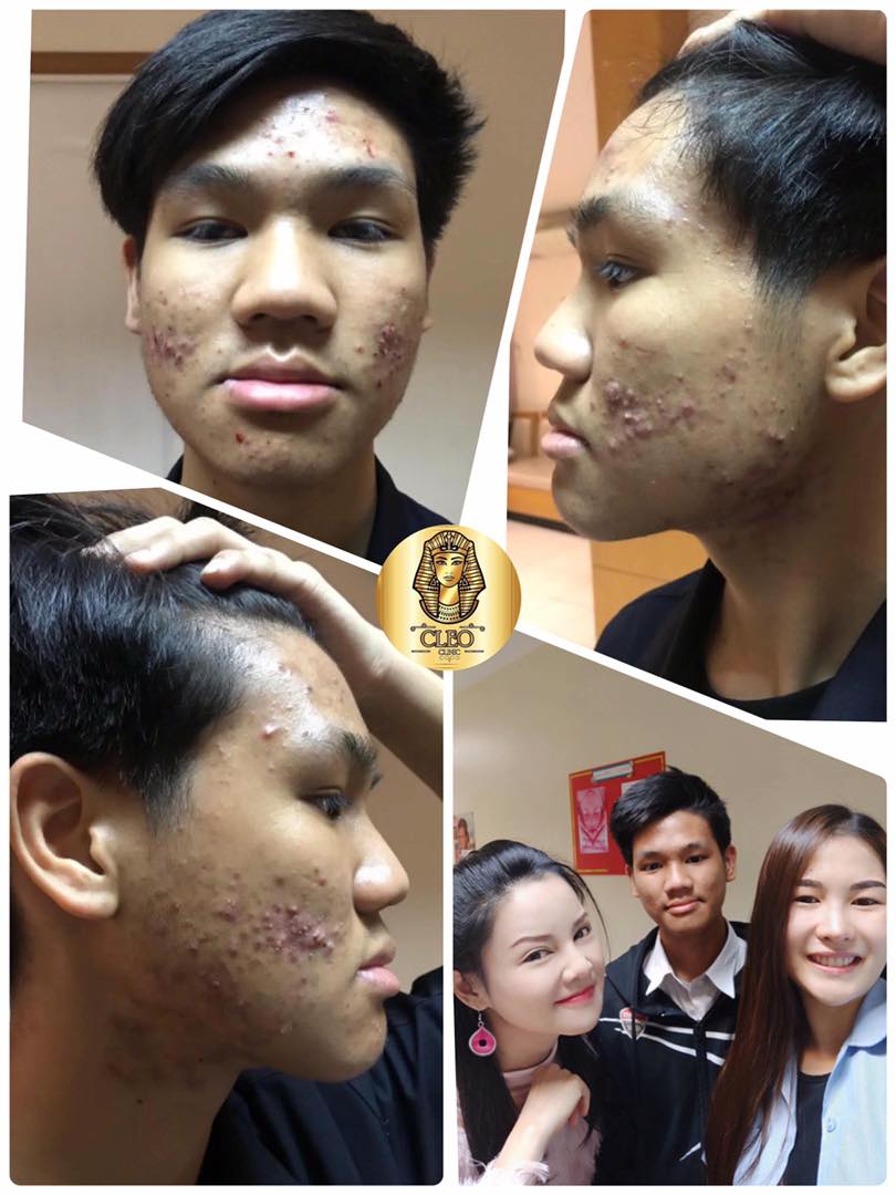 รีวิว ปี 62