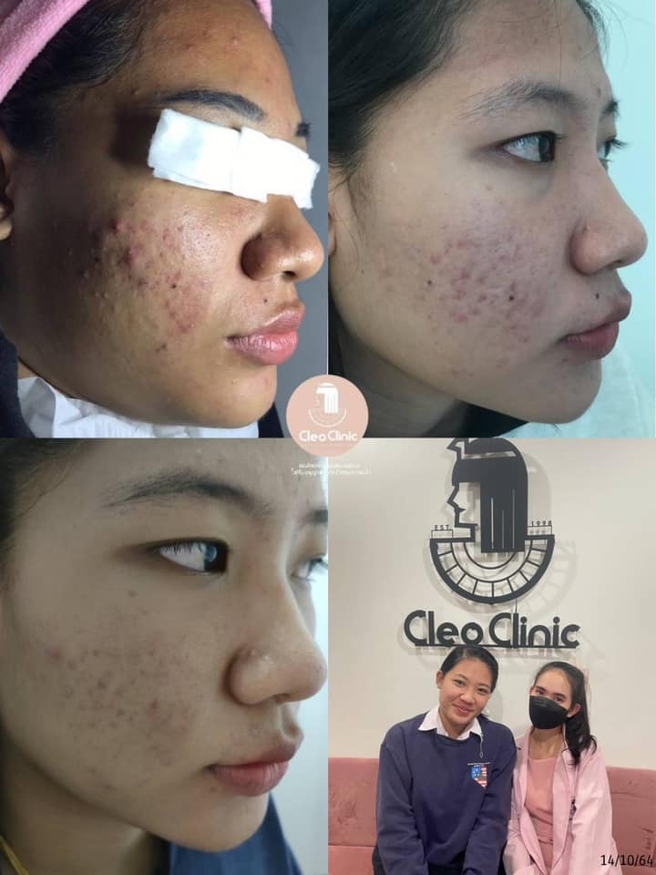 รีวิว ปี 62