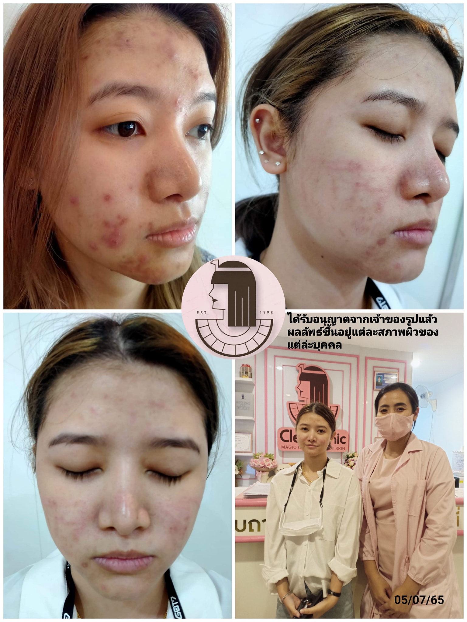 รีวิว ปี 62