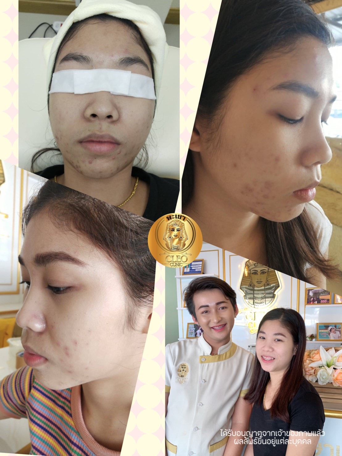 รีวิว ปี 62