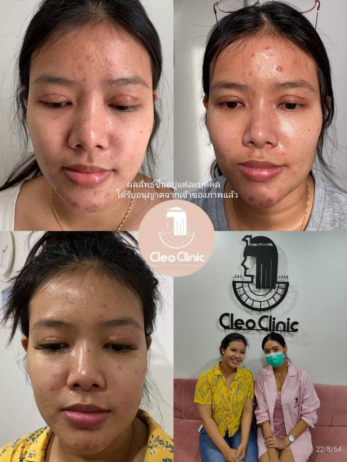 รีวิว ปี 62