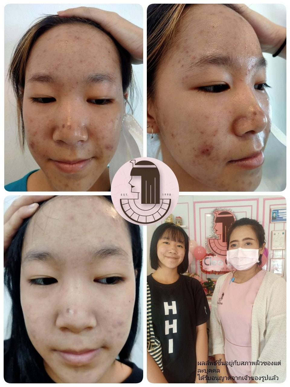 รีวิว ปี 62