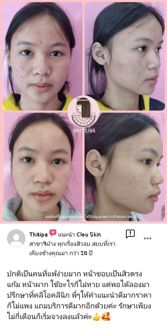 รีวิว ปี 62